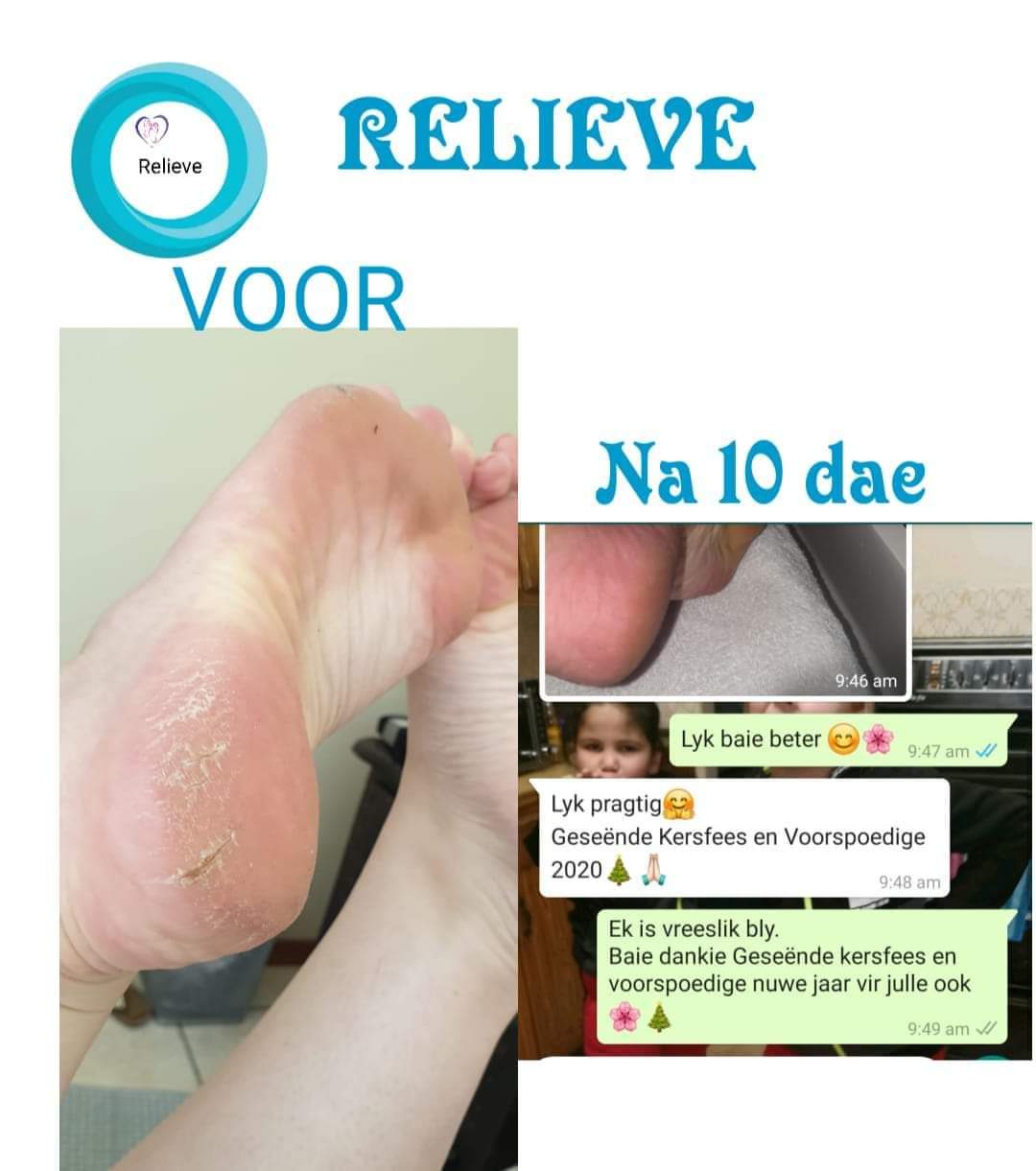 Relieve Balm 125ml