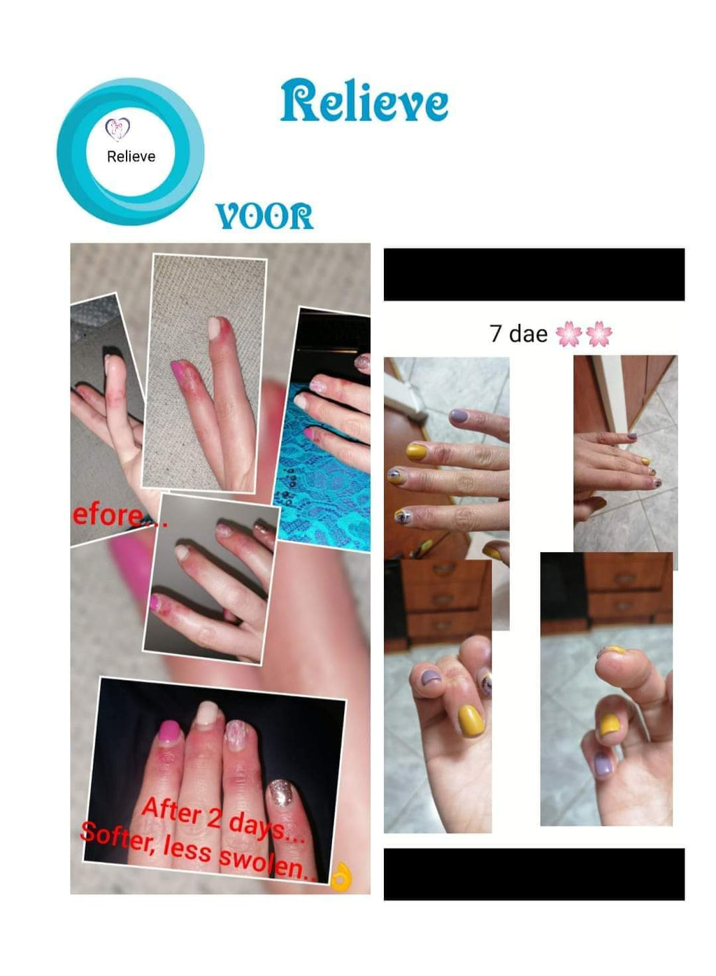Relieve Balm Travel Sticks