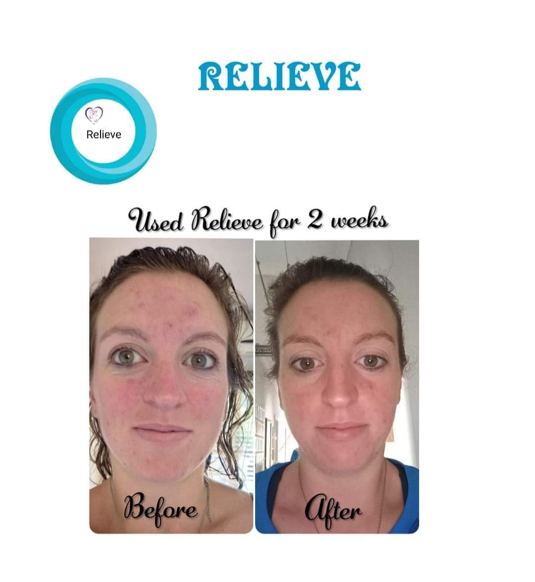 Relieve Balm Travel Sticks